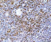 IHC staining of FFPE human tonsil tissue with TRAILR2 antibody. HIER: boil tissue sections in pH8 EDTA for 20 min and allow to cool before testing.