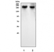 Western blot testing of human 1) MCF7 and 2) HaCaT cell lysate with Carcinoembryonic Antigen antibody. Expected molecular weight: 80~200 kDa depending on glycosylation level.
