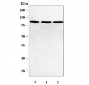 Western blot testing of human 1) 293T, 2) HeLa and 3) MCF7 cell lysate with PPP1R15B antibody. Predicted molecular weight ~79 kDa but may be observed at up to ~100 kDa, possibly due to phosphorylation.