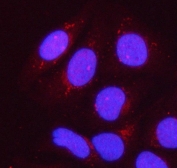 Immunofluorescent staining of FFPE human HeLa cells with PPP1R15B antibody (red) and DAPI nuclear stain (blue). HIER: steam section in pH6 citrate buffer for 20 min.