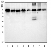 Western blot testing of 1) human HeLa, 2) human 293T, 3) human Daudi, 4) human HEL, 5) rat liver, 6) rat L6, 7) mouse liver and 8) mouse C2C12 cell lysate with Glucosidase 2 subunit beta antibody. Predicted molcular weight ~59 kDa but may be observed at higher molecular weights due to glycosylation.