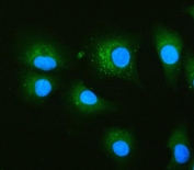 Immunofluorescent staining of FFPE human A549 cells with Glucosidase 2 subunit beta antibody (green) and DAPI nuclear stain (blue). HIER: steam section in pH6 citrate buffer for 20 min.