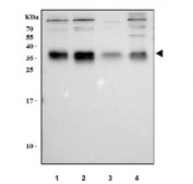 Western blot testing of human 1) 293T, 2) RT4, 3) ThP-1 and 4) A549 cell lysate with TM2D3 antibody. Predicted molecular weight ~27 kDa but may be observed at higher molecular weights due to glycosylation.