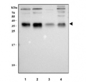 Western blot testing of human 1) 293T, 2) RT4, 3) ThP-1 and 4) A549 cell lysate with TM2D3 antibody. Predicted molecular weight ~27 kDa but may be observed at higher molecular weights due to glycosylation.
