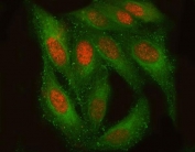 Immunofluorescent staining of FFPE human HeLa cells with TM2D3 antibody (green) and DAPI nuclear stain (blue). HIER: steam section in pH6 citrate buffer for 20 min.