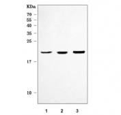 Western blot testing of 1) human ThP-1, 2) rat liver and 3) mouse liver tissue lysate with Glutathione Peroxidase 1 antibody. Predicted molecular weight ~22 kDa.