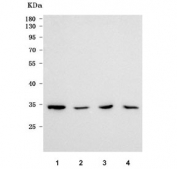Western blot testing of human 1) Raji, 2) HepG2, 3) SH-SY5Y and 4) K562 cell lysate with ILPIP antibody. Predicted molecular weight: 31-47 kDa (multiple isoforms).