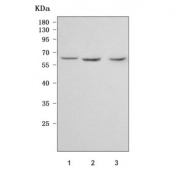 Western blot testing of human 1) HeLa, 2) 293T and 3) PC-3 cell lysate with PPAN antibody. Predicted molecular weight: 53-58 kDa (multiple isoforms).