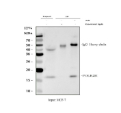 Immunoprecipitation of POLR2H protein from 500ug of human MCF7 whole cell lysate with 2ug of POLR2H antibody.