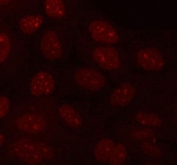 Immunofluorescent staining of FFPE human A431 cells with TAPP-1 antibody. HIER: steam section in pH6 citrate buffer for 20 min.