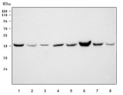 Western blot testing of 1) human HeLa, 2) human HepG2, 3) rat testis, 4) rat brain, 5) rat heart, 6) mouse testis, 7) mouse brain and 8) mouse heart tissue lysate with Phosphoglycerate kinase 2 antibody. Predicted molecular weight ~45 kDa.
