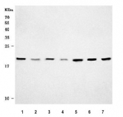 Western blot testing of 1) human HeLa, 2) human Jurkat, 3) human A431, 4) human 293T, 5) rat brain, 6) rat C6 and 7) mouse brain tissue lysate with CDC42 antibody. Predicted molecular weight ~21 kDa.