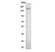 Western blot testing of human HeLa cell lysate with LDLR antibody. Expected molecular weight: 95-160 kDa depending on glycosylation level.