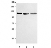 Western blot testing of human 1) K562, 2) HepG2 and 3) 293T cell lysate with POLR1B antibody. Predicted molecular weight ~128 kDa.