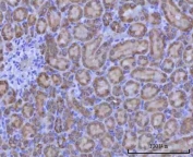 IHC staining of FFPE rat kidney tissue with Renin antibody. HIER: boil tissue sections in pH8 EDTA for 20 min and allow to cool before testing.