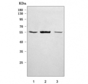 Western blot testing of human 1) 293T, 2) HepG2 and 3) HUH-7 cell lysate with Renin antibody. Predicted molecular weight ~45 kDa but may be observed at higher molecular weights due to glycosylation.