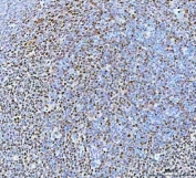 IHC staining of FFPE human chronic tonsillitis tissue with B-cell lymphoma/leukemia 11B antibody. HIER: boil tissue sections in pH8 EDTA for 20 min and allow to cool before testing.