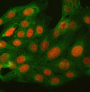 Immunofluorescent staining of FFPE human U-2 OS cells with B-cell lymphoma/leukemia 11B antibody (red) and Alpha Tubulin mAb (green). HIER: steam section in pH6 citrate buffer for 20 min.