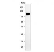 Western blot testing of human MOLT4 cell lysate with B-cell lymphoma/leukemia 11B antibody. Predicted molecular weight ~96 kDa but the modified forms of the protein can be observed at ~130 kDa.