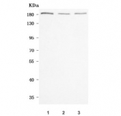 Western blot testing of human 1) A549, 2) PC-3 and 3) U-251 cell lysate with Neurabin 1 antibody. Predicted molecular weight ~123 kDa with multiple isoforms. This protein is commonly observed at ~180 kDa (p180) and ~140 kDa.