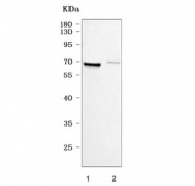 Western blot testing of human 1) U-87 MG and 2) HepG2 cell lysate with Matrix metalloproteinase 2 antibody. Predicted molecular weight ~72 kDa.