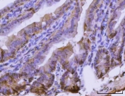 IHC staining of FFPE mouse colon tissue with Epcam antibody. HIER: boil tissue sections in pH8 EDTA for 20 min and allow to cool before testing.