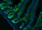 Immunofluorescent staining of FFPE mouse colon tissue with Epcam antibody (green) and DAPI nuclear stain (blue). HIER: steam section in pH8 EDTA buffer for 20 min.