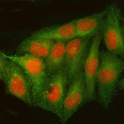 Immunofluorescent staining of FFPE human HeLa cells with CREB-2 antibody (red) and Alpha Tubulin mAb (green). HIER: steam section in pH6 citrate buffer for 20 min.