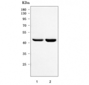 Western blot testing of human 1) HeLa and 2) Caco-2 cell lysate with PRDM7 antibody. Predicted molecular weight ~ 56 kDa, ~18 kDa and ~46 kDa (three isoforms).