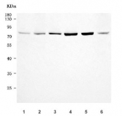 Western blot testing of 1) Jurkat, 2) human 293T, 3) human HeLa, 4) human K562, 5) rat C6 and 6) mouse NIH 3T3 cell lysate with PRKCA antibody. Predicted molecular weight ~77 kDa.