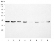 Western blot testing of 1) human HepG2, 2) human A549, 3) human HeLa, 4) human 293T, 5) rat brain, 6) rat RH35, 7) mouse brain and 8) mouse Neuro-2a cell lysate with HRMT1L2 antibody. Predicted molecular weight: 40-42 kDa (multiple isoforms).