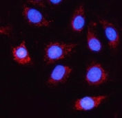 Immunofluorescent staining of FFPE human A549 cells with NDUFA5 antibody (red) and DAPI nuclear stain (blue). HIER: steam section in pH6 citrate buffer for 20 min.