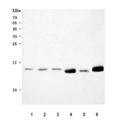 Western blot testing of 1) human 293T, 2) human PC-3), 3) human HepG2, 4) rat heart, 5) rat kidney and 6) mouse heart tissue lysate with NDUFA7 antibody. Predicted molecular weight ~13 kDa.