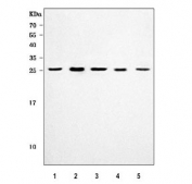 Western blot testing of 1) human HeLa, 2) human 293T, 3) human Jurkat, 4) rat brain and 5) mouse brain tissue lysate with HGPRTase antibody. Predicted molecular weight ~24 kDa.