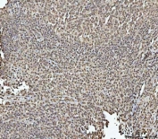 IHC staining of FFPE human tonsil tissue with OTT1 antibody. HIER: boil tissue sections in pH8 EDTA for 20 min and allow to cool before testing.