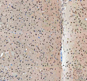 IHC staining of FFPE mouse brain tissue with OTT1 antibody, HRP-secondary and DAB substrate. HIER: boil tissue sections in pH8 EDTA for 20 min and allow to cool before testing.