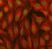 Immunofluorescent staining of FFPE human U-2 OS cells with OTT1 antibody (green) and Alpha Tubulin mAb (red). HIER: steam section in pH6 citrate buffer for 20 min.