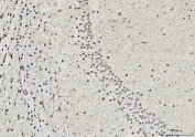 IHC staining of FFPE rat brain tissue with OTT1 antibody. HIER: boil tissue sections in pH8 EDTA for 20 min and allow to cool before testing.