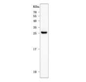 Western blot testing of human HepG2 cell lysate with Plasmolipin antibody. Predicted molecular weight ~20 kDa.