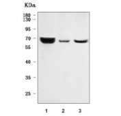 Western blot testing of human 1) placenta, 2) SiHa and 3) U-251 cell lysate with LPLA2 antibody. Predicted molecular weight ~47 kDa and 36 kDa (two isoforms) but may be observed at higher molecular weights due to glycosylation.