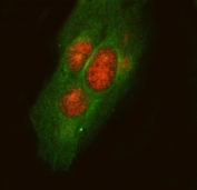 Immunofluorescent staining of FFPE human U-2 OS cells with LPLA2 antibody (red) and Alpha Tubulin mAb (green). HIER: steam section in pH6 citrate buffer for 20 min.