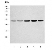 Western blot testing of 1) human HepG2, 2) human HeLa, 3) rat brain, 4) mouse brain and 5) mouse thymus tissue lysate with NADK2 antibody. Predicted molecular weight ~49, 46 and 32 kDa (multiple isoforms).