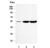Western blot testing of human 1) HeLa, 2) SiHa and 3) RT4 cell lysate with C14orf50 antibody. Predicted molecular weight ~49 kDa.