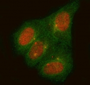Immunofluorescent staining of FFPE human HeLa cells with C14orf50 antibody (red) and Alpha Tubulin mAb (green). HIER: steam section in pH6 citrate buffer for 20 min.