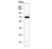Western blot testing of human MCF7 cell lysate with PRDM8 antibody. Predicted molecular weight ~72 kDa.