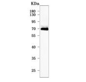Western blot testing of human MCF7 cell lysate with PRDM8 antibody. Predicted molecular weight ~72 kDa.