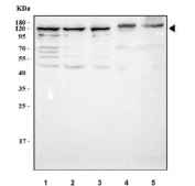 Western blot testing of 1) human 293T, 2) human HEL, 3) human SH-SY5Y, 4) rat liver and 5) mouse liver tissue lysate with NAA16 antibody. Predicted molecular weight ~101 kDa with multiple smaller isoforms.