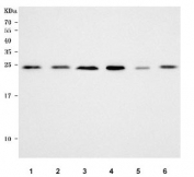 Western blot testing of 1) human HepG2, 2) human HeLa, 3) human Jurkat, 4) rat testis, 5) rat liver and 6) mouse testis tissue lysate with PPP1R11 antibody. Predicted molecular weight ~14 kDa, commonly observed at ~26 kDa. (Ref 1)