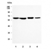 Western blot testing of 1) human HCCT, 2) human HCCP, 3) rat liver and 4) rat RH35 cell lysate with PIGS antibody. Predicted molecular weight ~61 kDa.