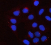 Immunofluorescent staining of FFPE human U-2 OS cells with Apolipoprotein E antibody (red) and DAPI nuclear stain (blue). HIER: steam section in pH6 citrate buffer for 20 min.